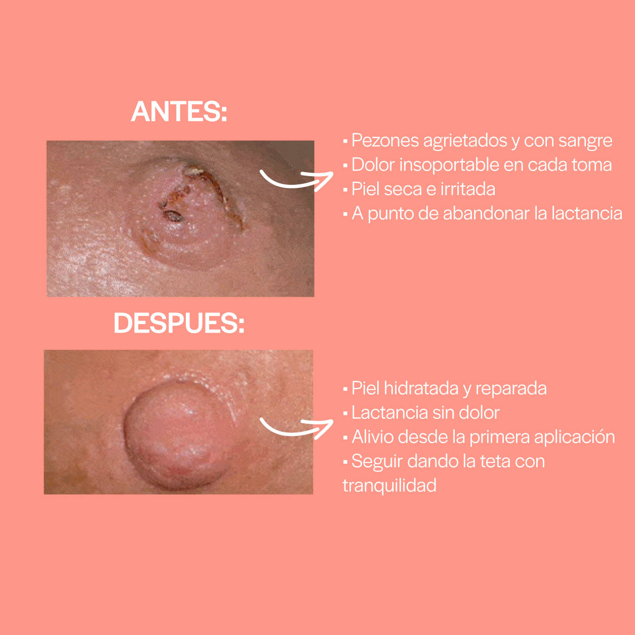 Vitta Crema para el Pecho - Alivio real para los pezones